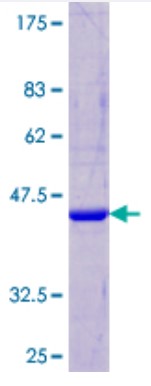 SDS-PAGE (CST5-2028H).jpg